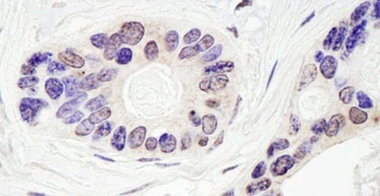 Rabbit anti-TDP1 Antibody