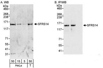 Rabbit anti-SFRS14 Antibody