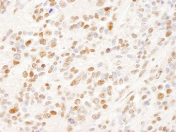Rabbit anti-SFRS14 Antibody