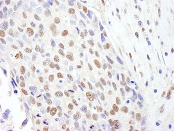 SF3b145/SAP145 Antibody