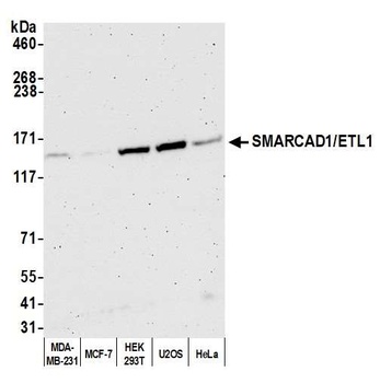 SMARCAD1/ETL1 Antibody