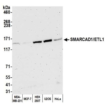 Rabbit anti-SMARCAD1/ETL1 Antibody