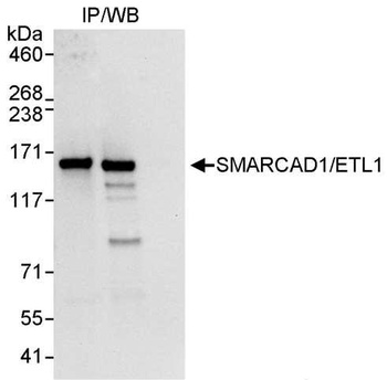 Rabbit anti-SMARCAD1/ETL1 Antibody