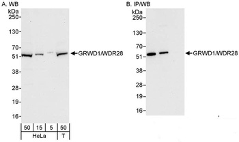 GRWD1/WDR28 Antibody