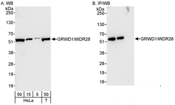 GRWD1/WDR28 Antibody