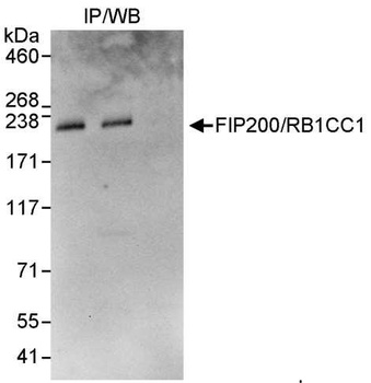 Rabbit anti-FIP200/RB1CC1 Antibody
