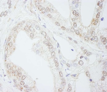 Rabbit anti-METTL3/MT-A70 Antibody