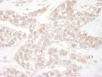 Rabbit anti-Flightless-1 Antibody