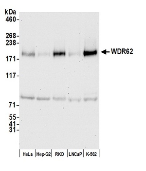 WDR62 Antibody