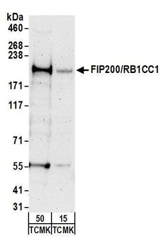 FIP200/RB1CC1 Antibody