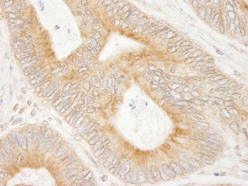 Rabbit anti-MAP7 Antibody