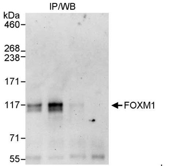 Rabbit anti-FOXM1 Antibody