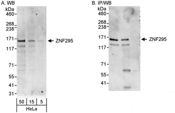 Rabbit anti-ZNF295 Antibody