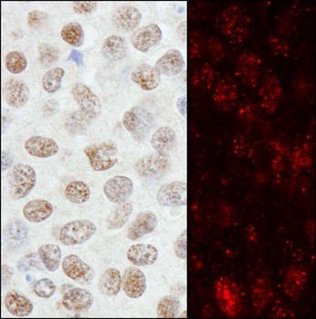 Rabbit anti-ZNF295 Antibody