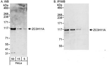 Rabbit anti-ZC3H11A Antibody