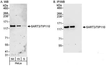 Rabbit anti-SART3/TIP110 Antibody