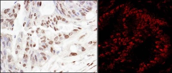 Rabbit anti-SART3/TIP110 Antibody
