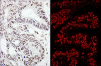 RanBP3 Antibody