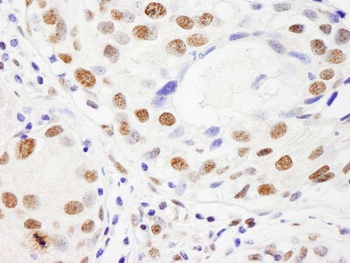 Rabbit anti-NUMA Antibody