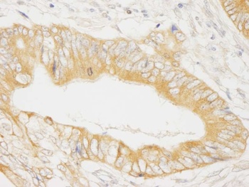 Rabbit anti-MAP4K4/HGK Antibody