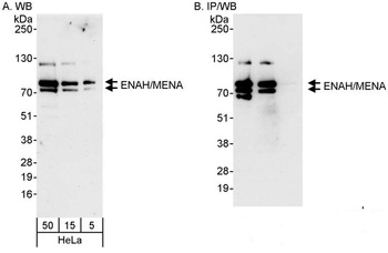 Rabbit anti-ENAH/MENA Antibody