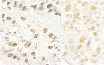 Rabbit anti-CROP/Luc7A Antibody
