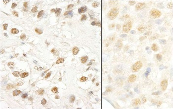 CROP/Luc7A Antibody