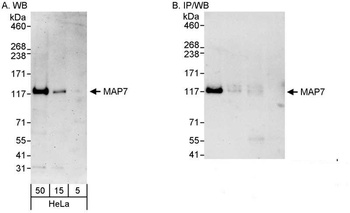 Rabbit anti-MAP7 Antibody