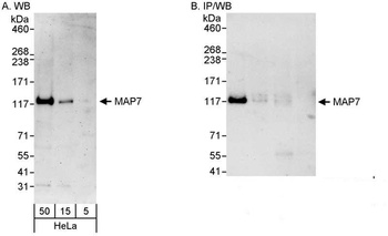 MAP7 Antibody