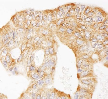Rabbit anti-MAP4 Antibody
