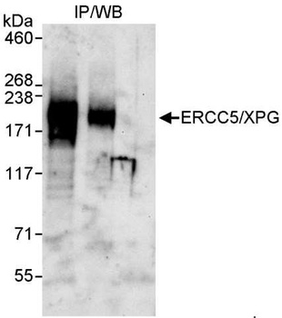 ERCC5/XPG Antibody