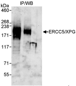 Rabbit anti-ERCC5/XPG Antibody