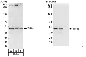 Rabbit anti-TIPIN Antibody
