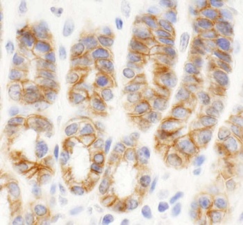 KIAA0528 Antibody