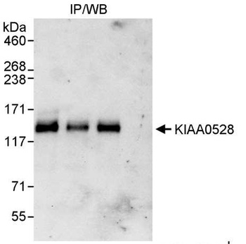 Rabbit anti-KIAA0528 Antibody