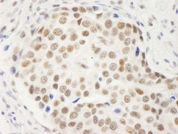 Rabbit anti-Symplekin Antibody