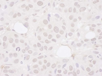 Rabbit anti-Symplekin Antibody