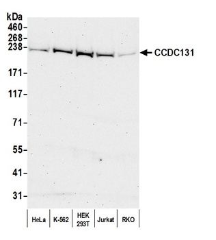 Rabbit anti-CCDC131 Antibody