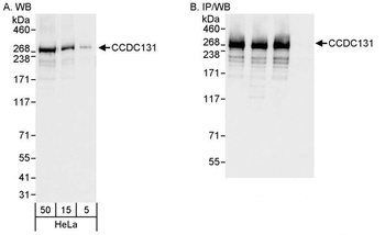 Rabbit anti-CCDC131 Antibody