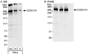Rabbit anti-CCDC131 Antibody