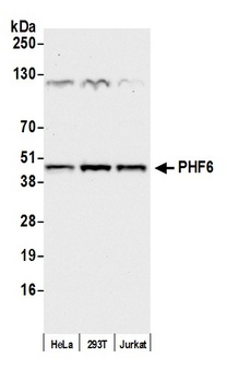 PHF6 Antibody