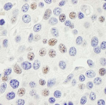 Rabbit anti-PHF6 Antibody