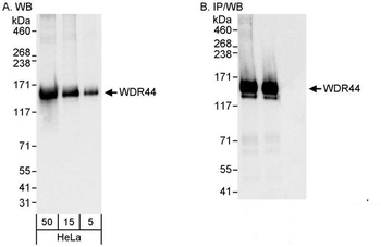 Rabbit anti-WDR44 Antibody