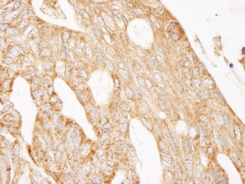 Rabbit anti-IRS2 Antibody