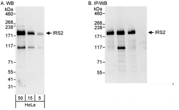 Rabbit anti-IRS2 Antibody