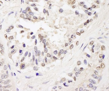 Rabbit anti-FOG1/ZFPM1 Antibody
