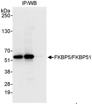 FKBP5/FKBP51 Antibody