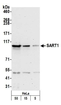 Rabbit anti-SART1 Antibody
