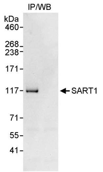 Rabbit anti-SART1 Antibody