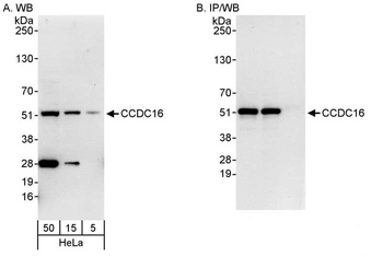 Rabbit anti-CCDC16 Antibody